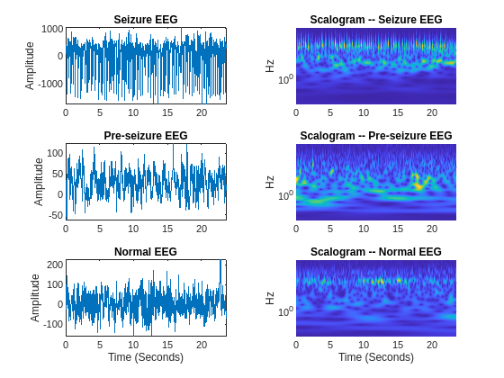 Time series and scalogram of seizure EEG, pre-seizure EEG, and normal EGG